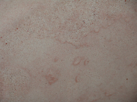 Quarzite rosa