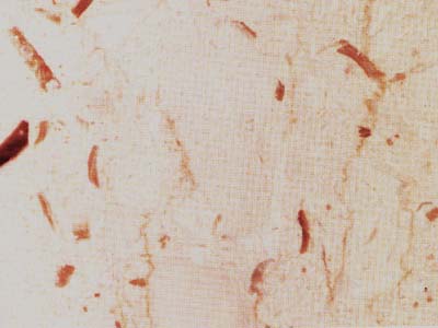 PERLATO SICILIA slabs tiles project