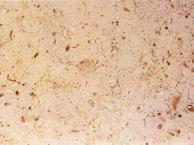 TRANI COCCIOLATO slabs tiles project